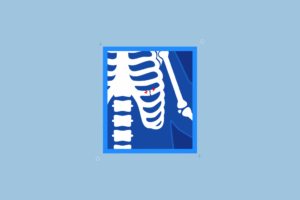 Featured_Image_for_How_to_Sleep_with_Broken_Ribs_for_Amerisleep-1024x683.png