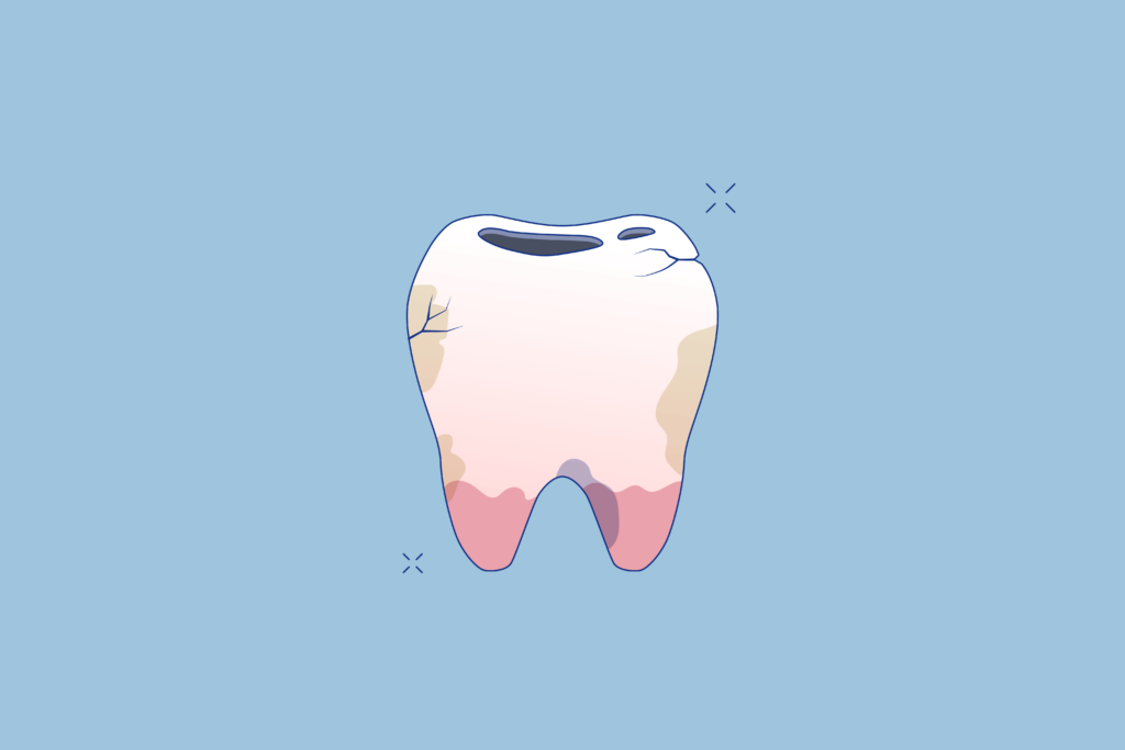Featured_Image_for_Amerisleep_How_to_Sleep_with_a_Toothache-1024x683.png